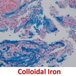 Colloidal Iron 100 Count