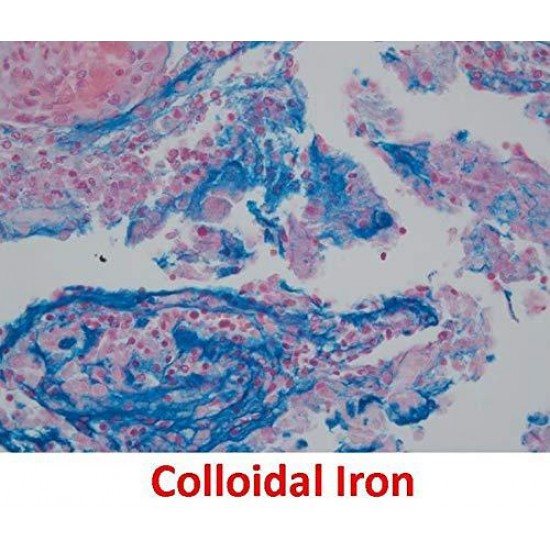 Colloidal Iron 100 Count